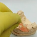 How to adjust partial dentures at home