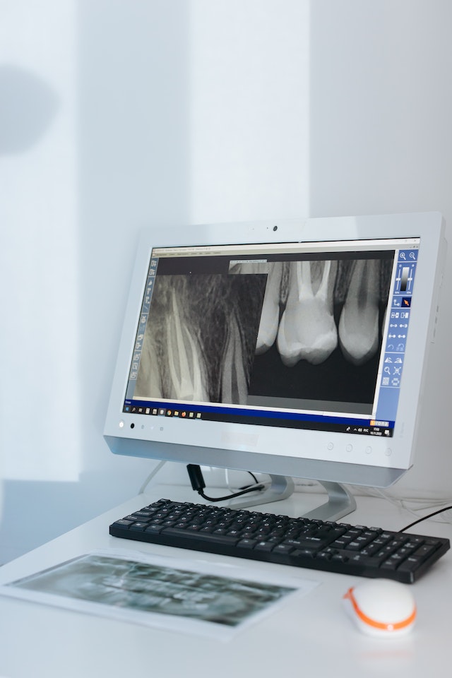 Pediatric dental x rays guidelines for 3 year old