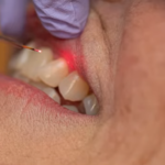 new treatments for periodontal disease