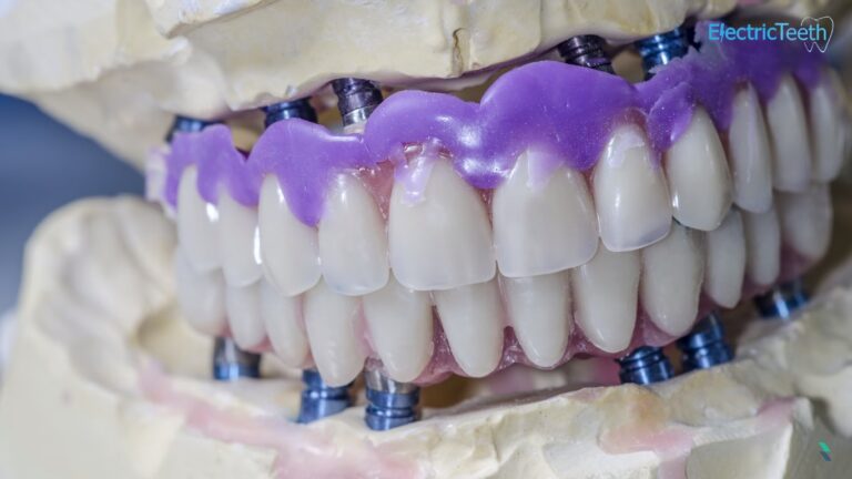 Dentures that you can wear all the time