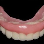 Lower denture problems and solutions