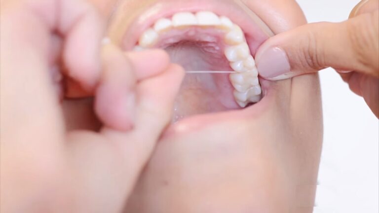 Long term benefits of flossing