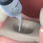 Best bone graft material for dental implant